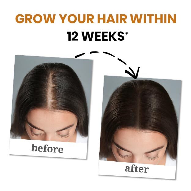 Hair Growth Solution Package